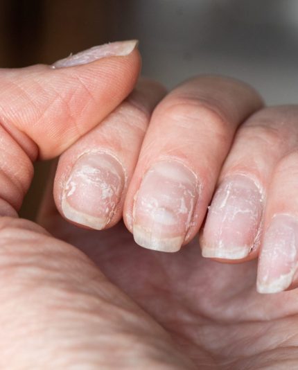 close-up van een hand met broze nagels voor een rubber base behandeling van Blue Sage. Model voor de opleiding nagelstyling - rubber base