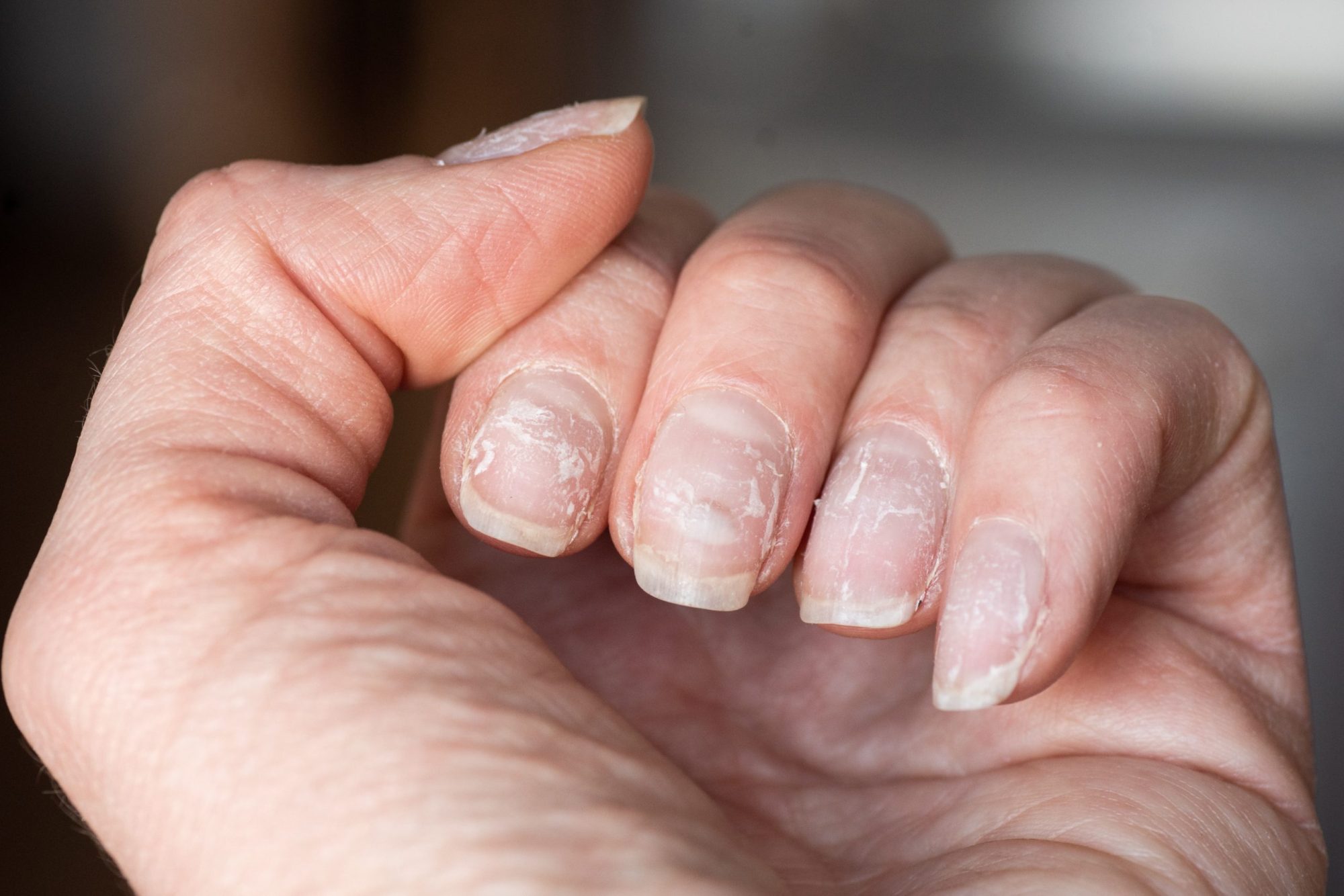 close-up van een hand met broze nagels voor een rubber base behandeling van Blue Sage. Model voor de opleiding nagelstyliste - rubber base