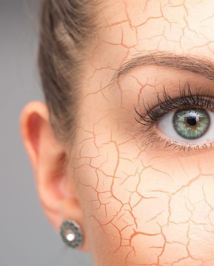 Jong vrouwengezicht met barstend effect, concept van huiduitdroging, huid-verbetrende producten tegen droge huid